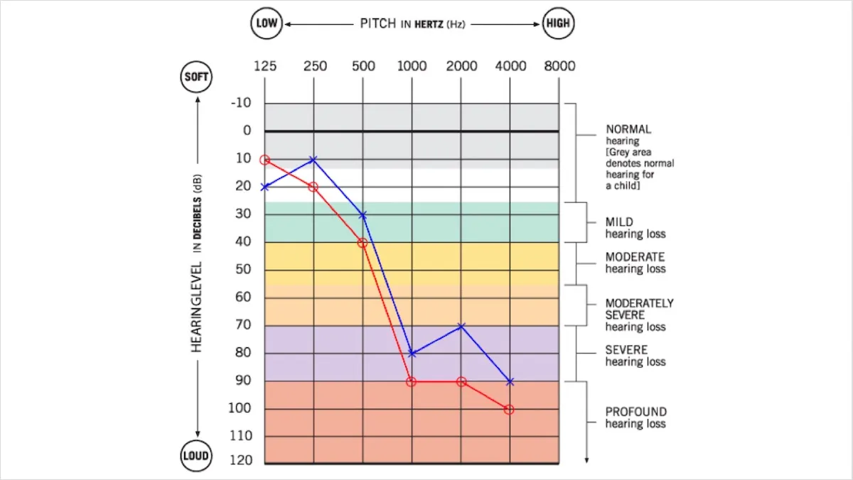 Audiogram