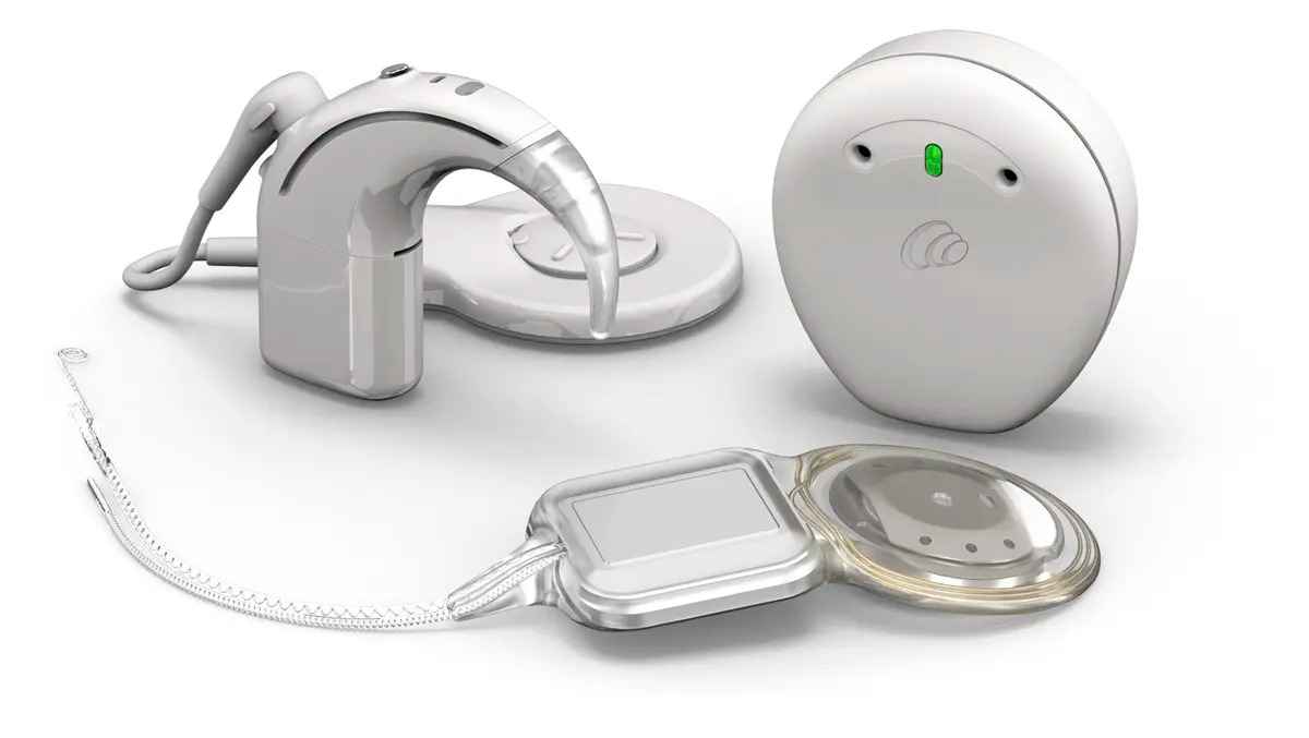Cochlear Launches World’s First and Only Smart Cochlear Implant System with upgradeable firmware