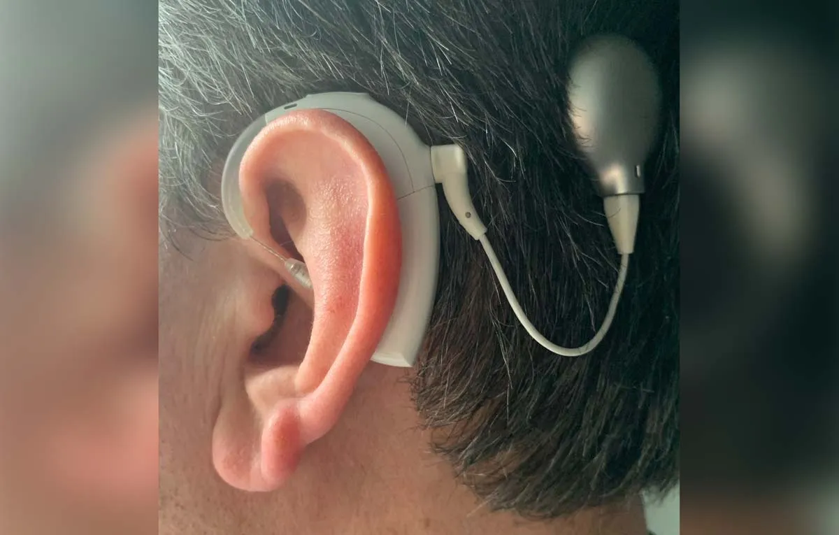 Sam's Cochlear Implant