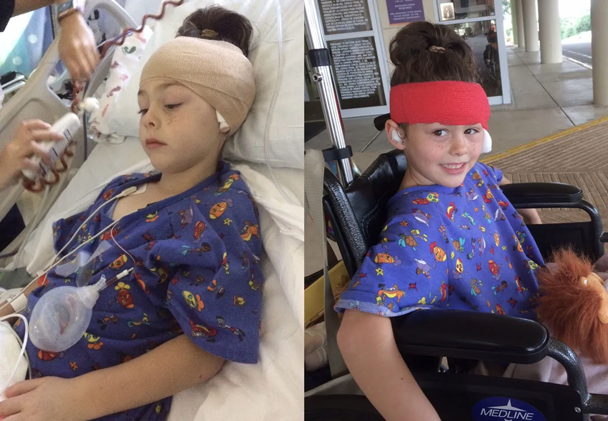 Matti had an operation called a Tympanoplasty to reconstruct her eardrums.