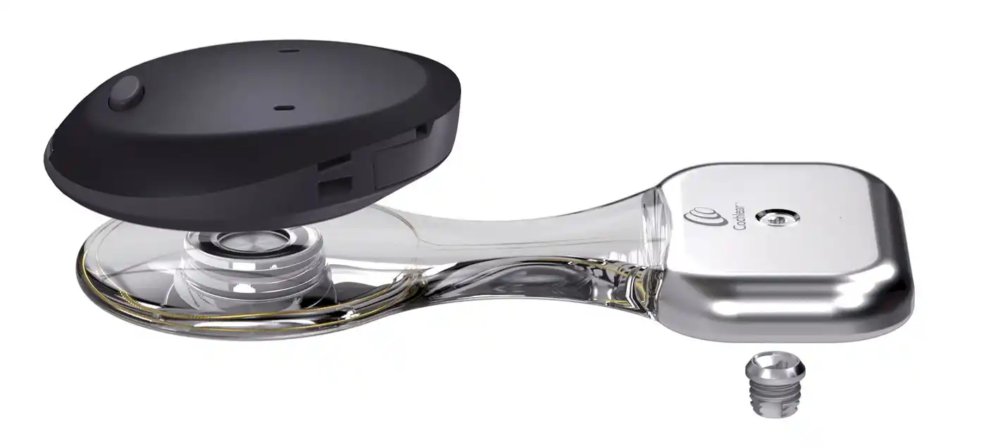 Die drei Komponenten des Cochlear Baha Osia System (von unten rechts nach oben links): 1) BI300-Titanimplantat; 2) das OSI200-Implantat mit Wandler, Antenne, digitaler Verbindung und Magnet; und 3) Osia System-Soundprozessor.