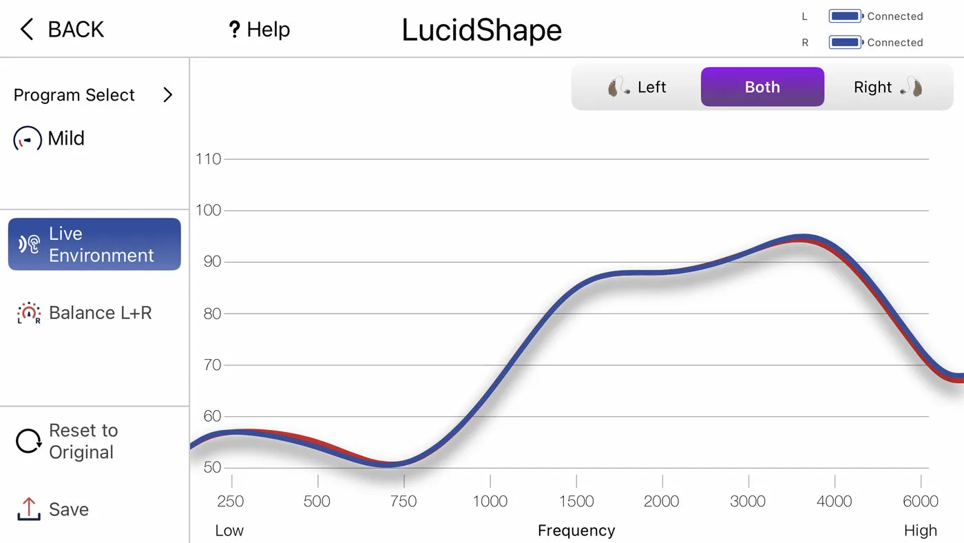 LucidShape™ with custom adjustments to Engage devices. 