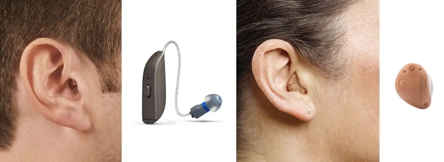 Open vs Closed Hearing Aids