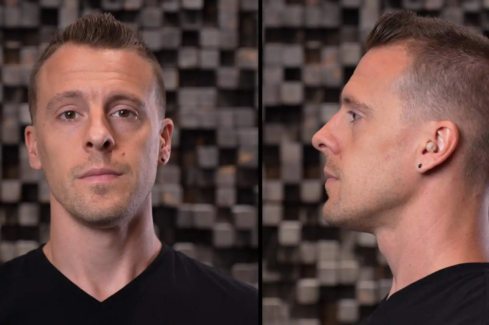 Front and side photos of how Atom Pro 2 hearing aids look inside your ears. 
