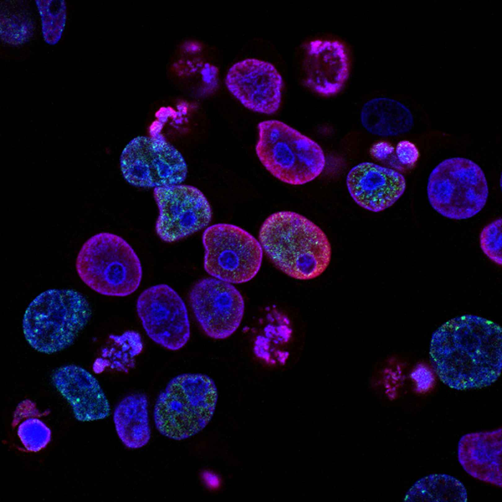 cancer and hearing loss