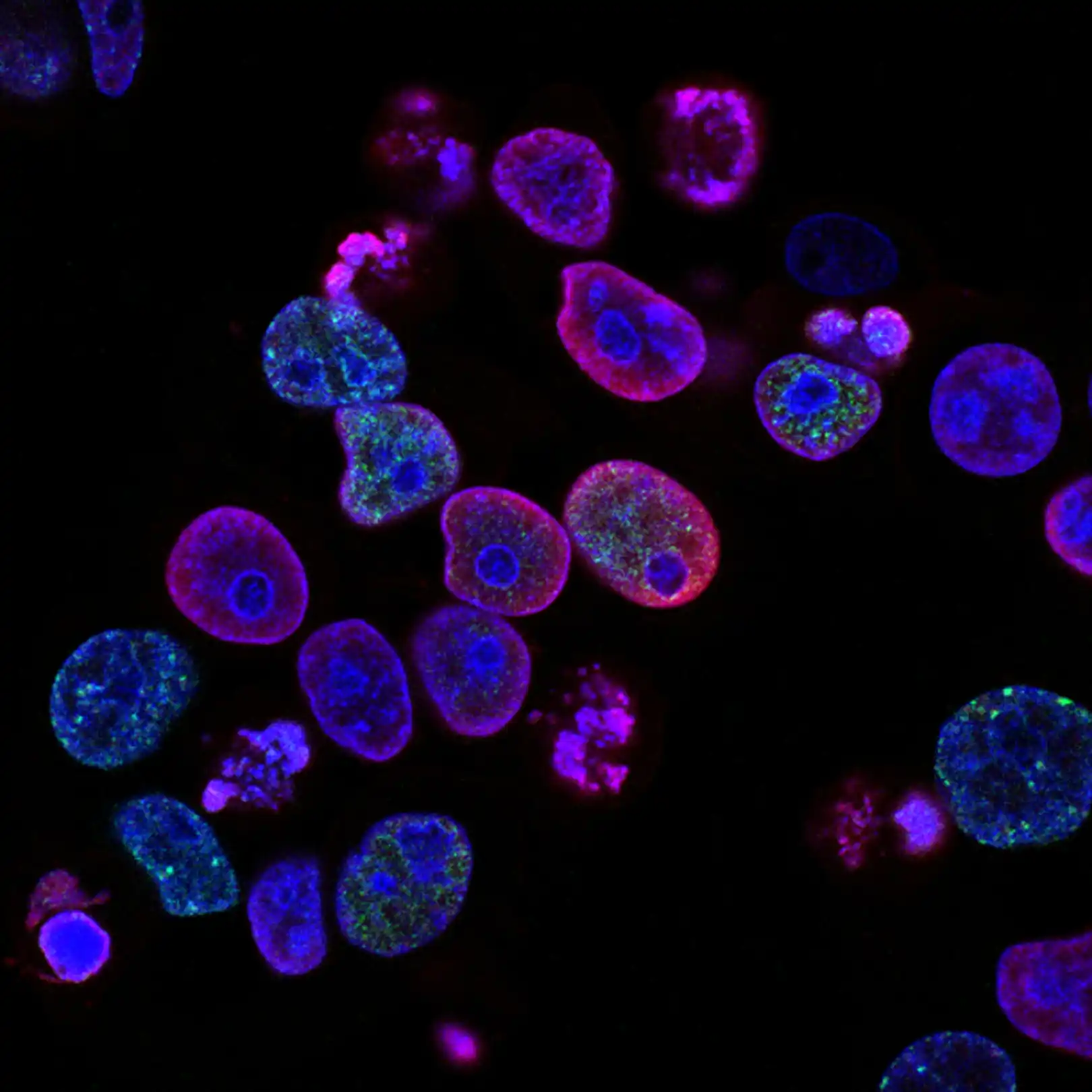 cancer and hearing loss