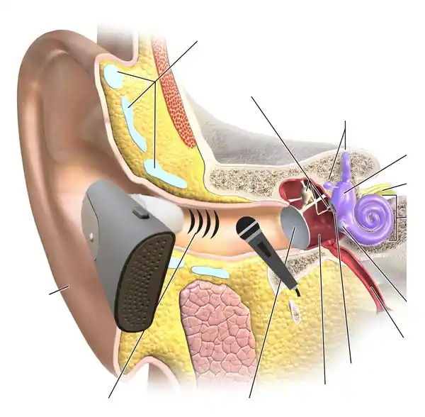 How Real Ear Measurements (REMs) Work