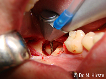 Chirurgie W&H 