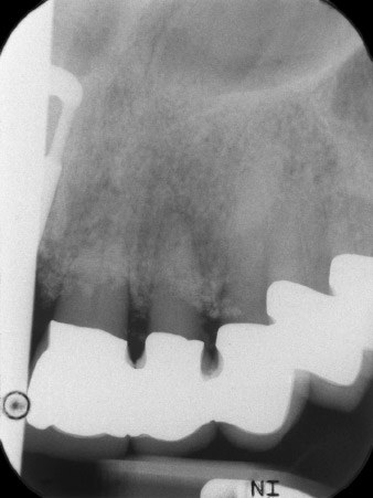 radiologischer Ausgangsbefund 