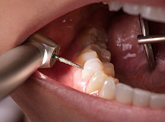 Alegra iluminación del lugar de tratamiento