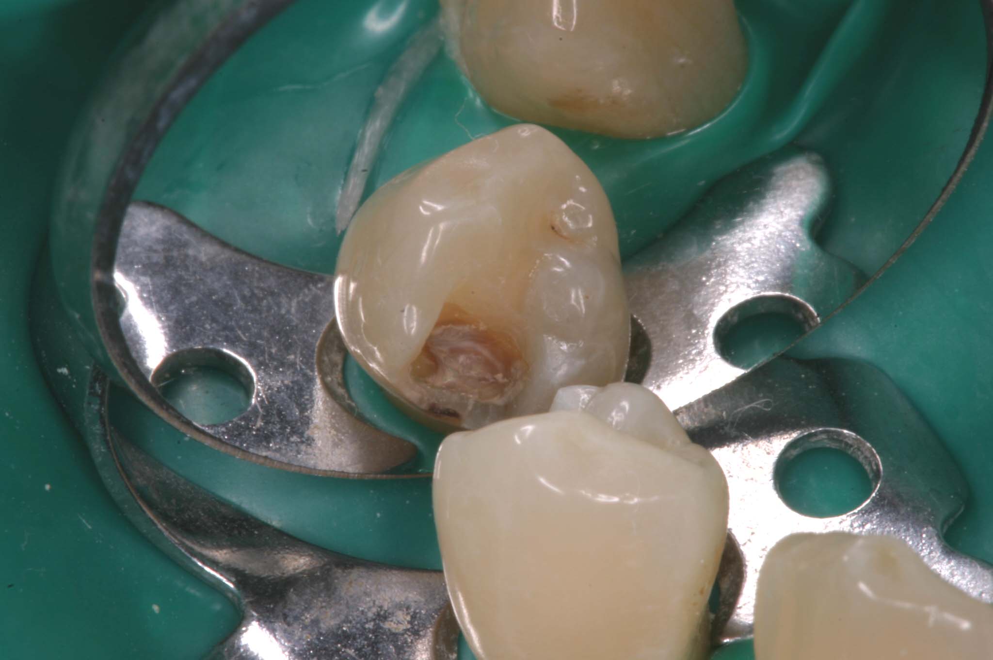 ohne Proface*