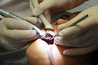 100% shadowless illumination