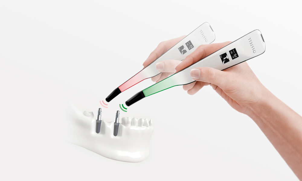 A hand is holding an Osstell Beacon above a denture, in front of a white background.