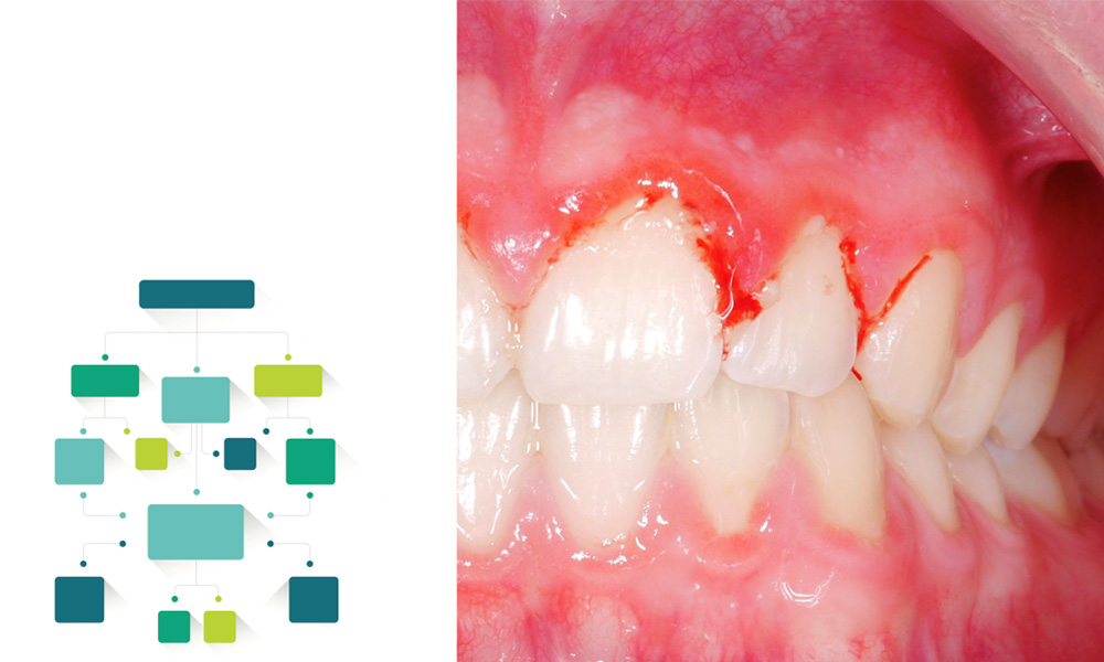 Periodontal diagnosis made easy
