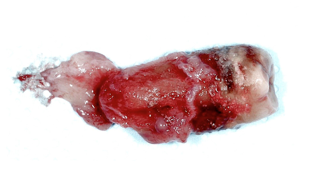 Успешно лечение – има ли значение? Част 2