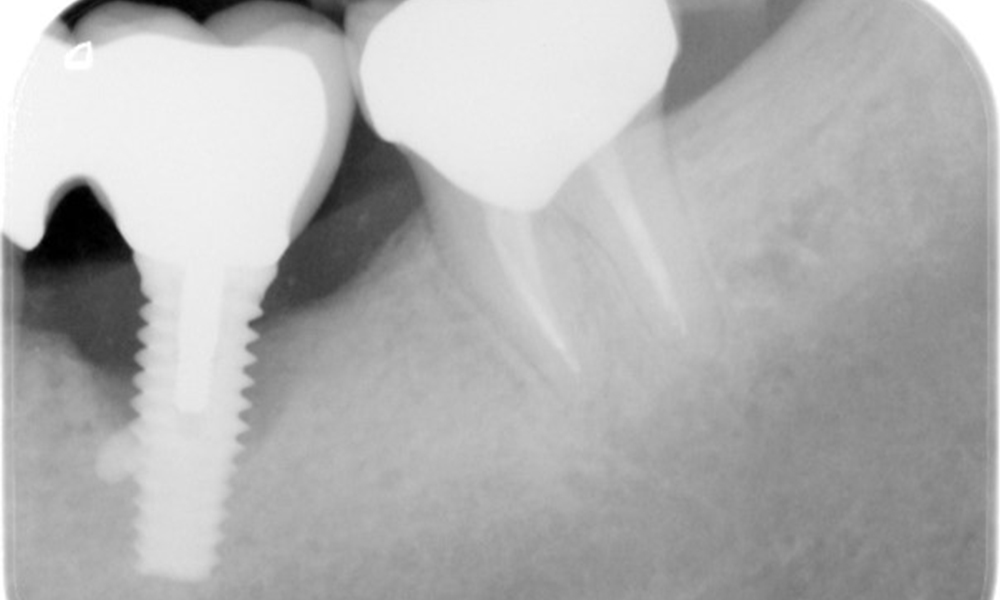 OPG: 26/02/2024 Dental X-ray: 18/01/2024