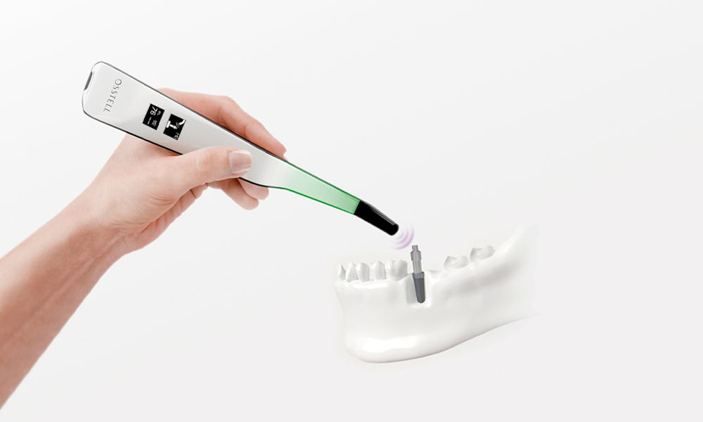 ISQ measurement of implant stability using the Osstell Beacon and SmartPeg on a dental model with an implant.