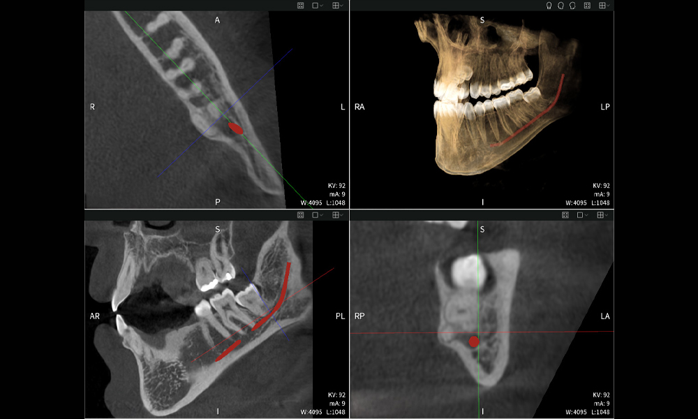 Figure a: Imaging results of Seethrough Max, in front of a black background.