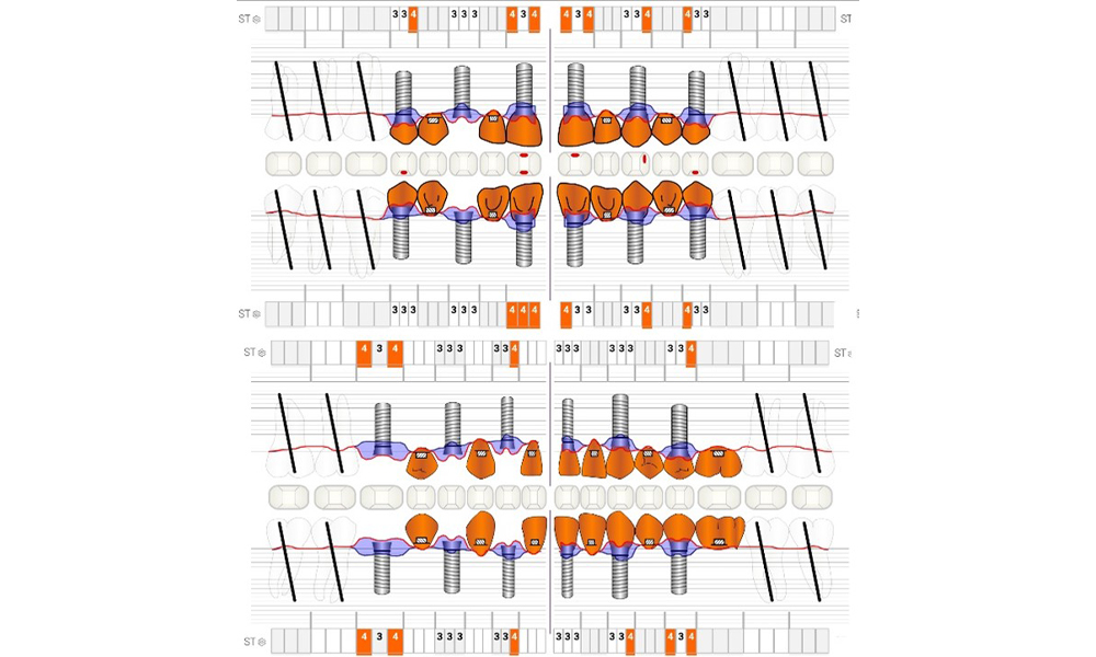 Periodontal Status (ParoStatus®.de)