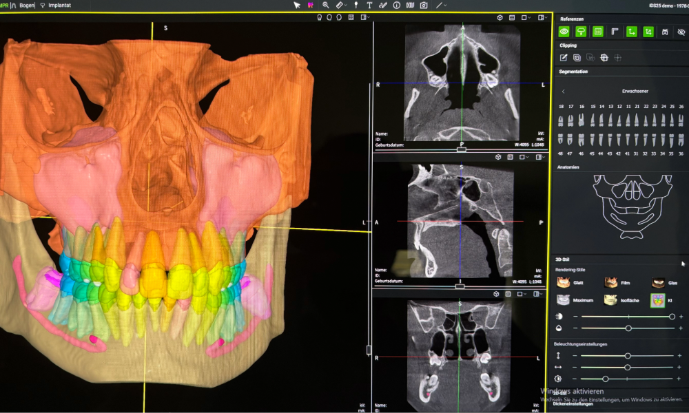 Digitale 3D-DVT-/CBCT-Röntgenaufnahme mit Zahnsegmentierung, Kieferdarstellung und anatomischer Analyse für Implantatplanung, Oralchirurgie und moderne zahnmedizinische Diagnostik.