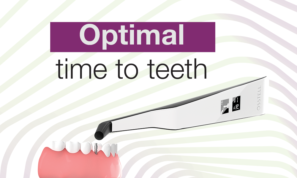  Osstell Beacon (right) in front of a white background.