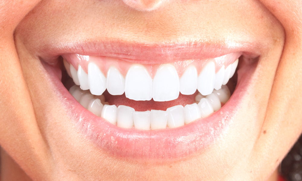 Traitement de la gingivite = patients plus heureux et en meilleure santé !