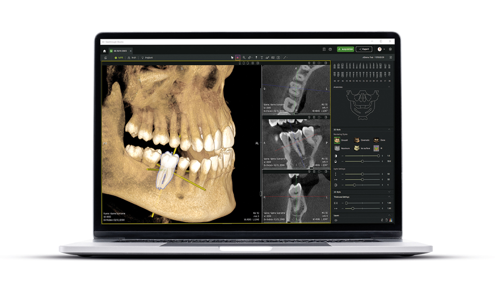 Die neue Seethrough Studio-Software gezeigt auf einem Laptop vor einem weißen Hintergrund.