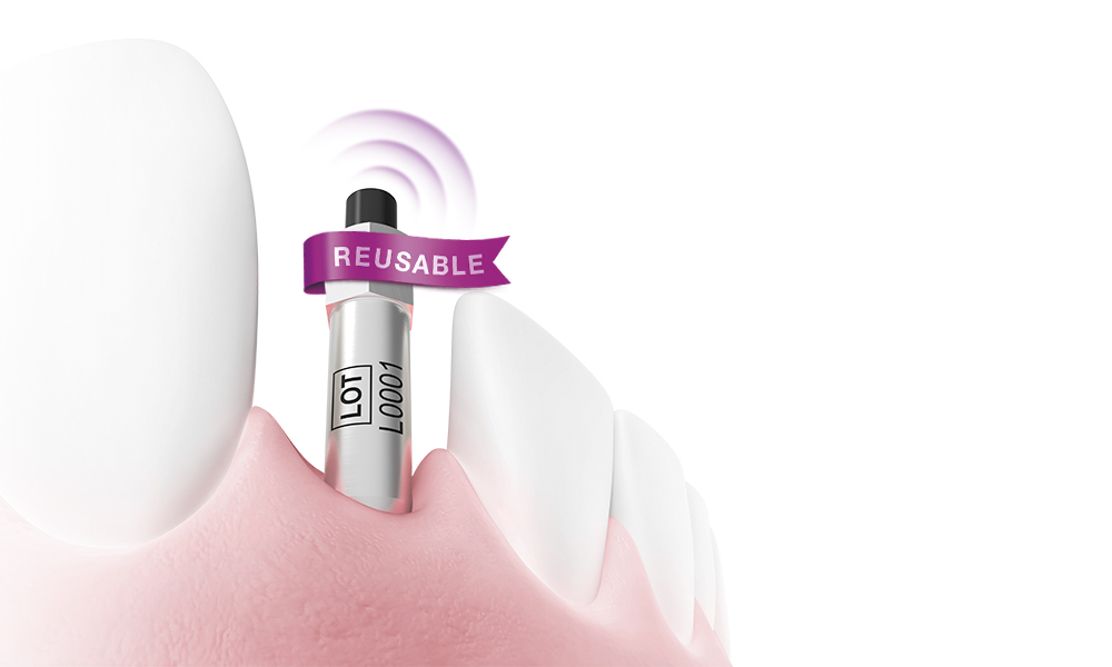 SmartPeg reusable version