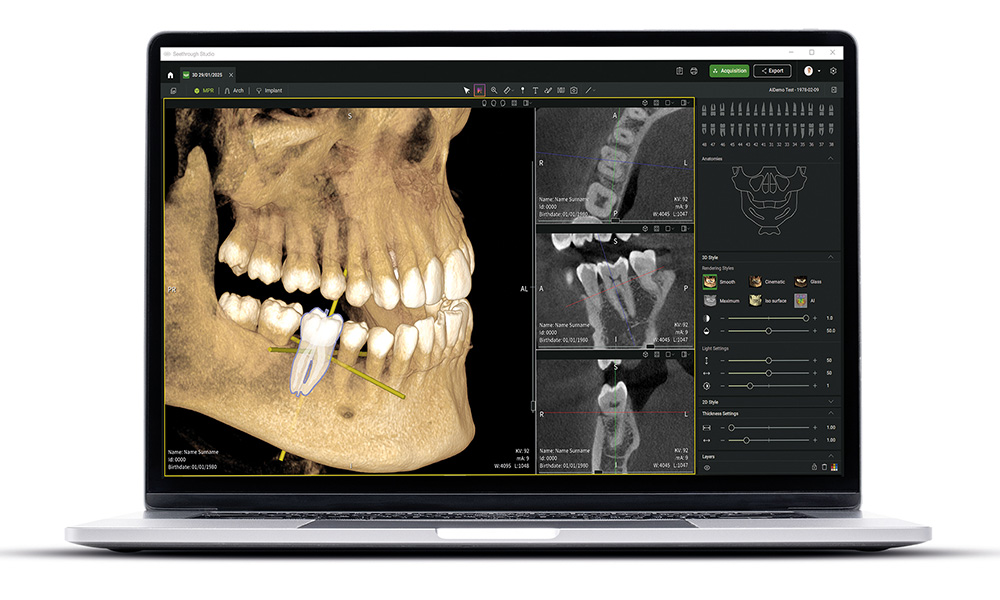 Seethrough Studio ensures sharp, detailed, and undistorted images.