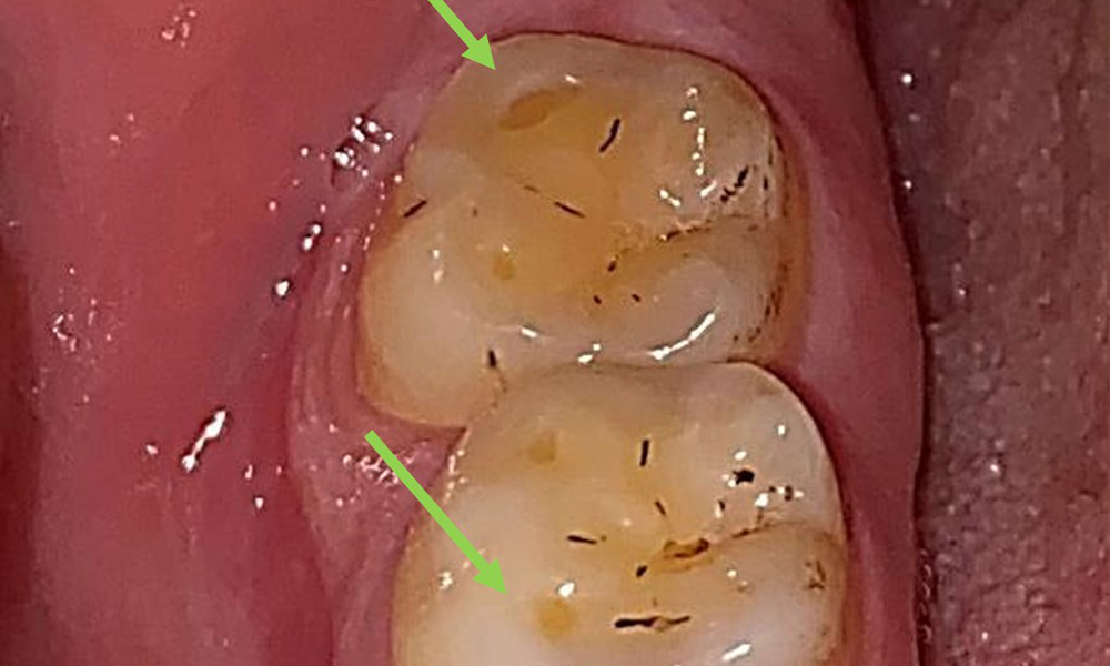 Close-up view of teeth