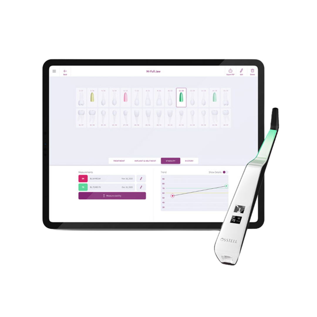 OsstellConnect
