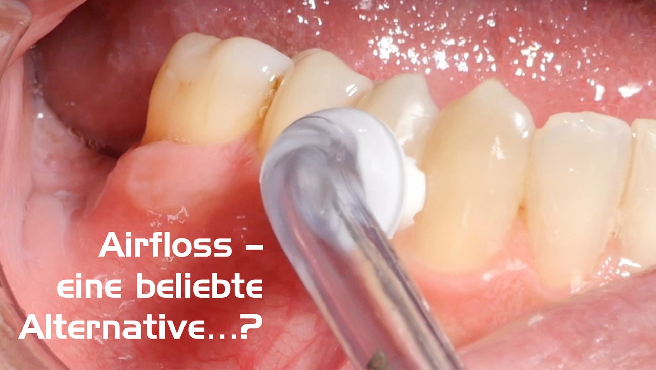 Airfloss – eine beliebte Alternative …? (Shutterstock)