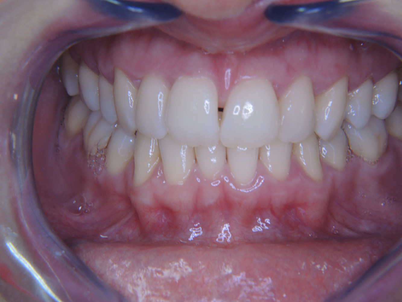 © Dr G. Schmalz y Dr D. Ziebolz MSc