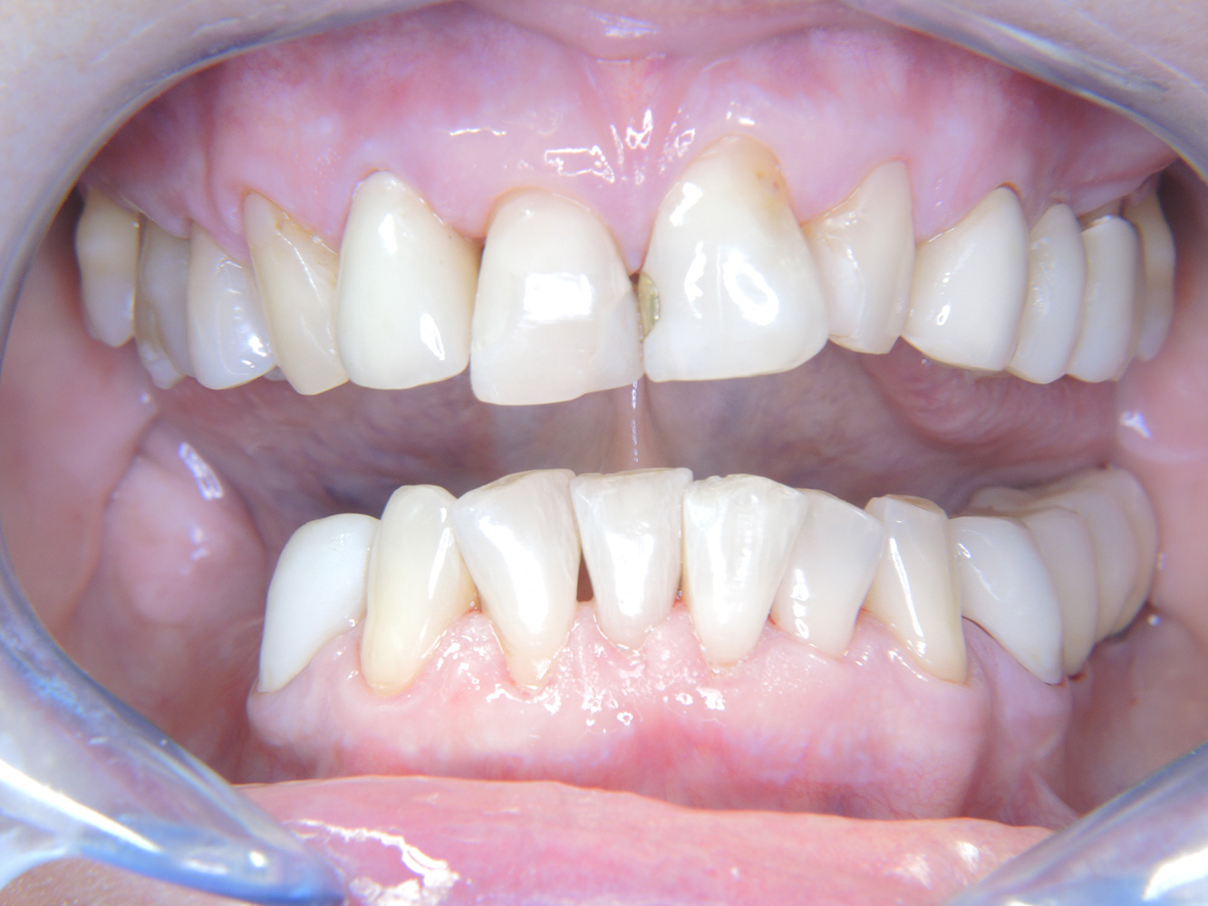 © Dr G. Schmalz y Dr D. Ziebolz MSc