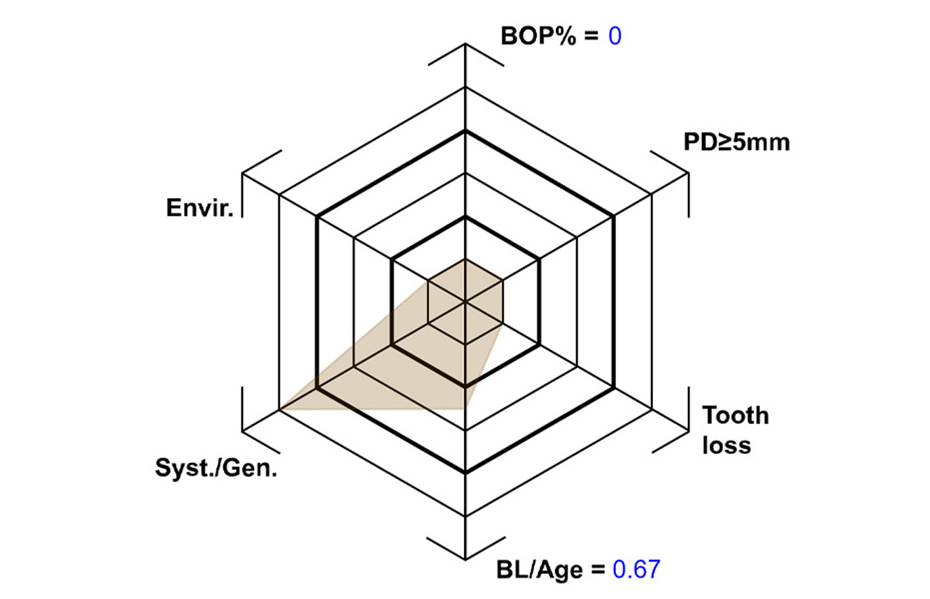 The endocarditis patient with active caries lesions