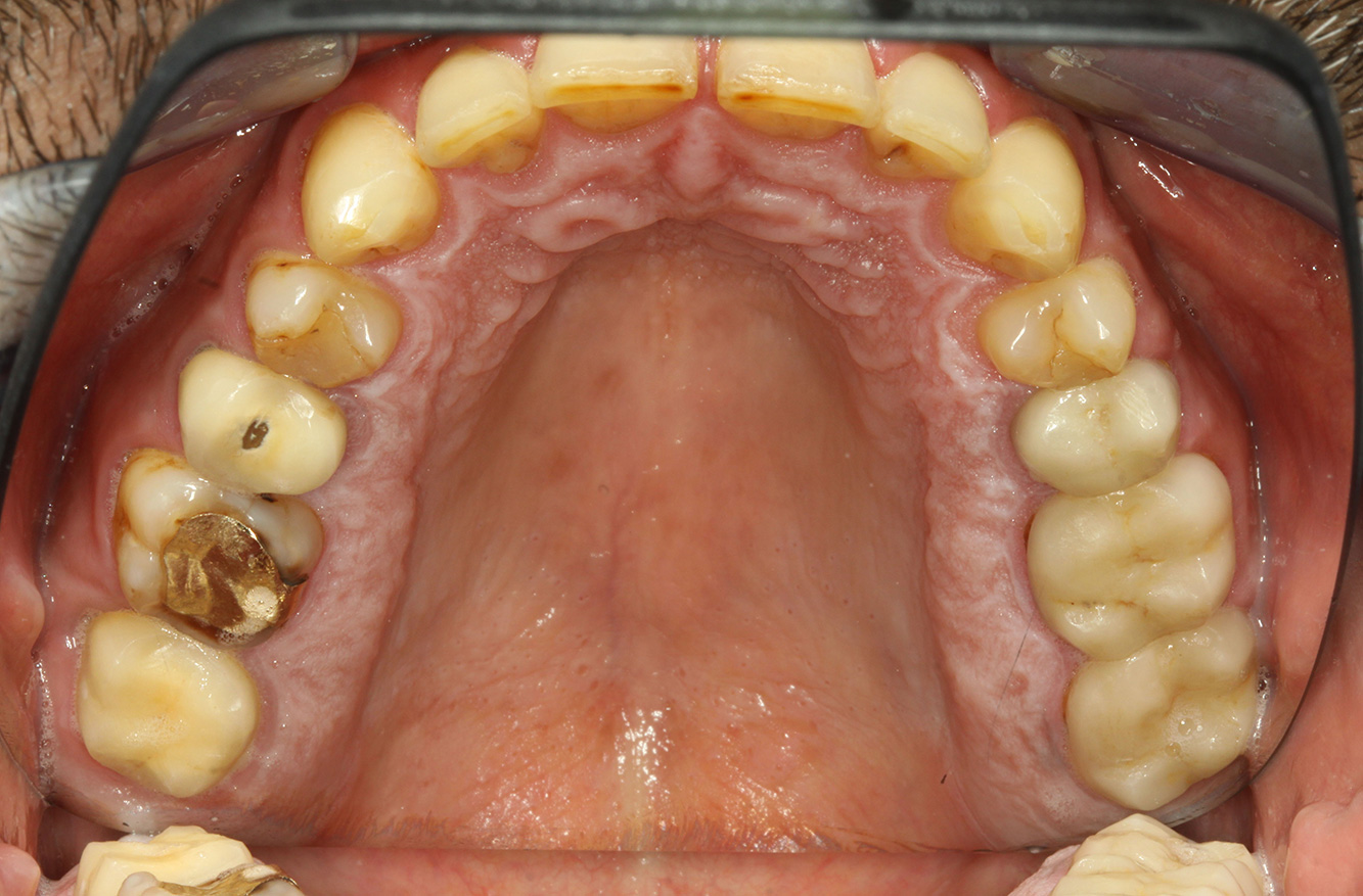 © Dr G. Schmalz y Dr D. Ziebolz MSc