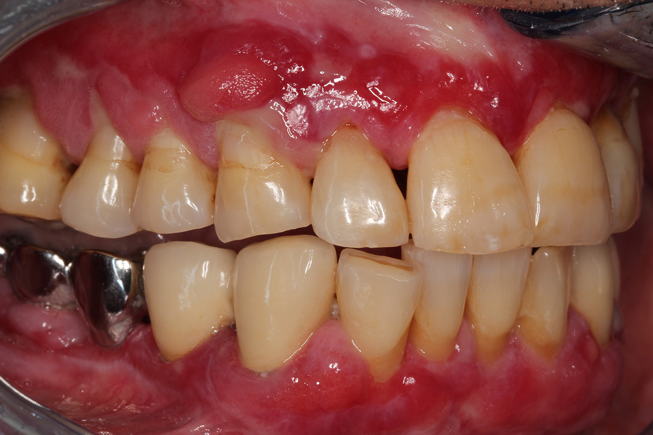 © Dr G. Schmalz y Dr D. Ziebolz MSc