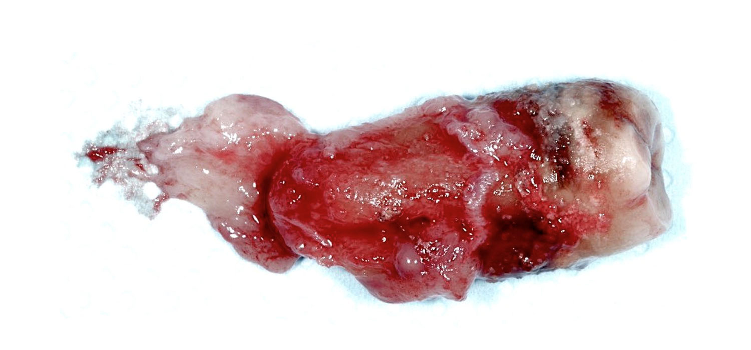 La réussite du traitement