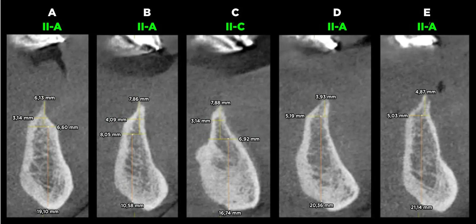 Evaluación de la calidad ósea