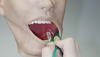 Contre angle de chirurgie W&H 