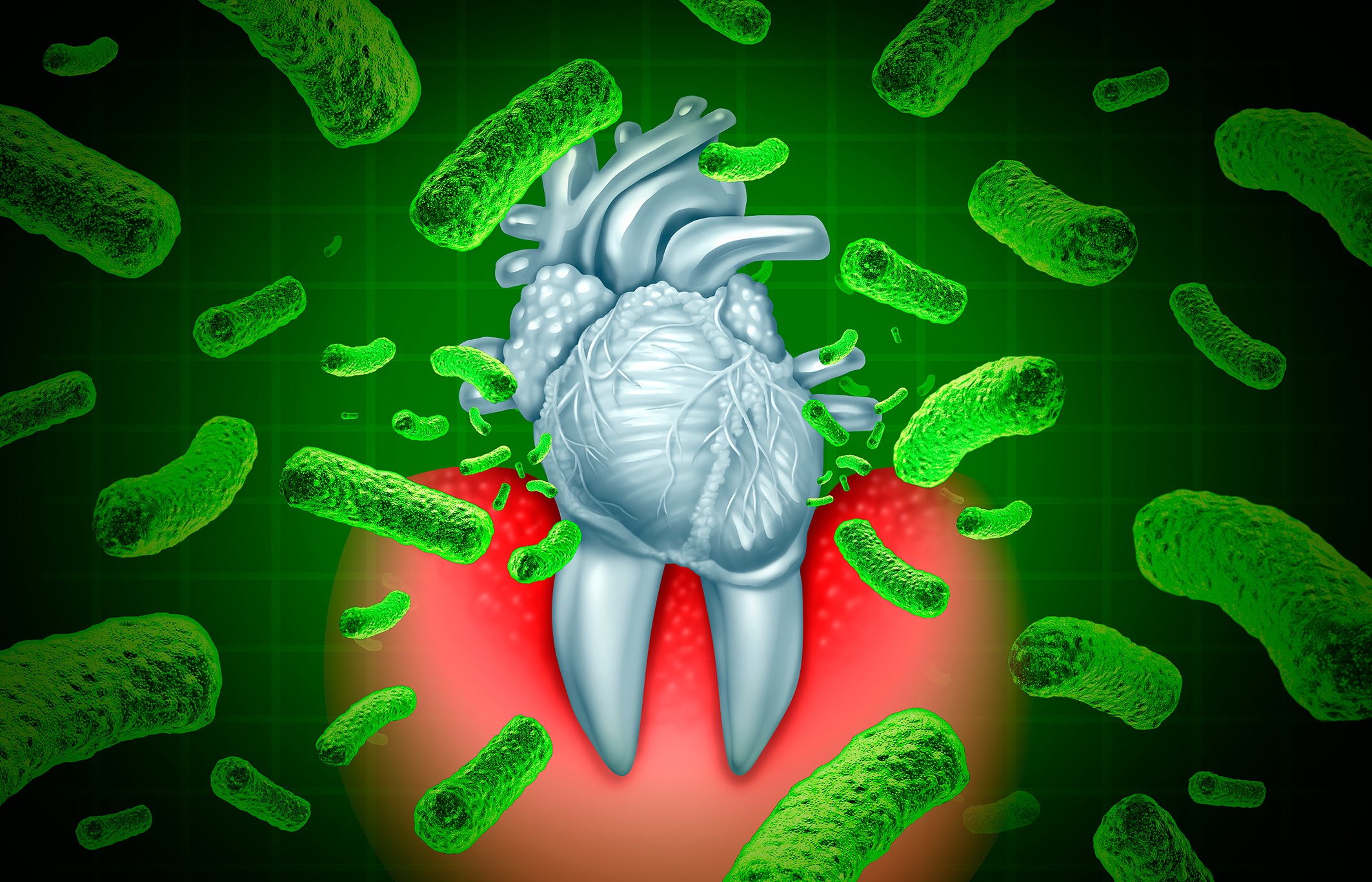 Periodontitis & cardiovascular diseases