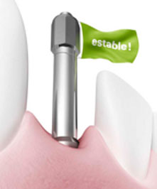 Osstell ISQ