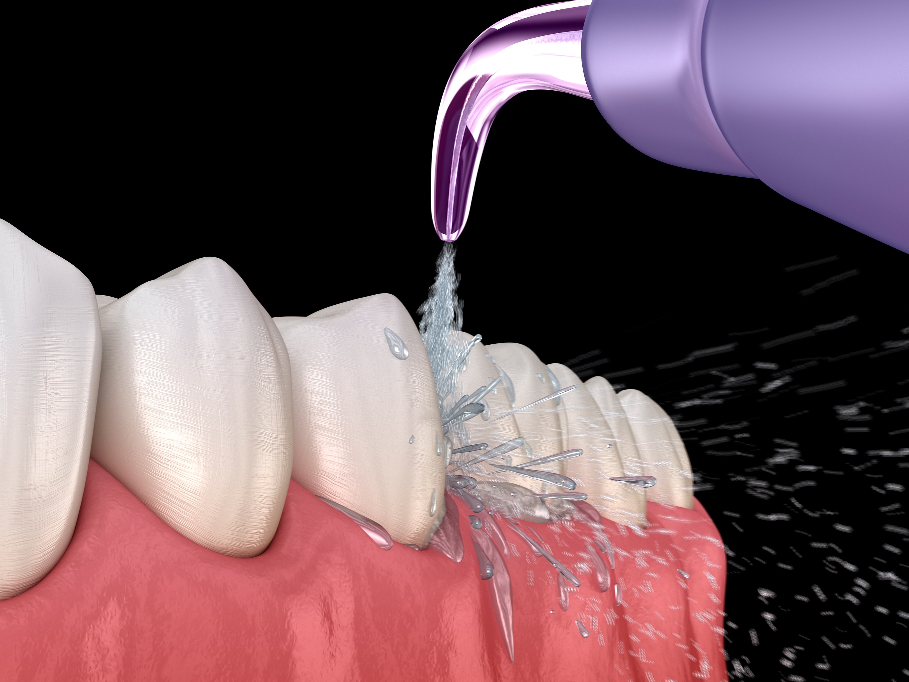 Interdentalraumbürste oder Munddusche? (Shutterstock)