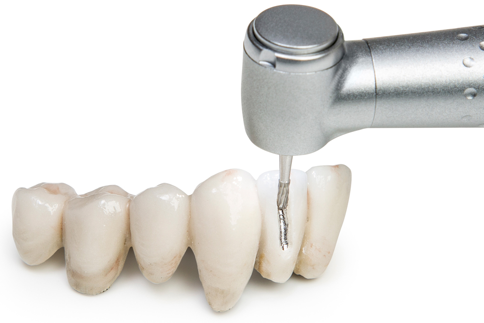 Cutting of crowns and bridges