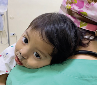 Child in the arms of a healthcare professional following surgical treatment during a Nicaplast humanitarian mission in Nicaragua.