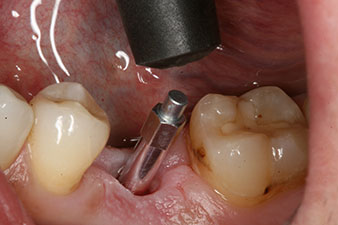 Sonde de mesure