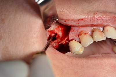 Perforazione inclinata