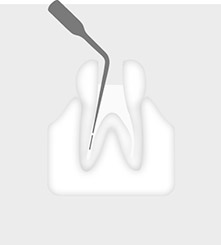 3E специален накрайник