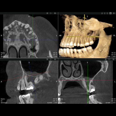 Imaging results of Seethrough Max, in front of a black background.