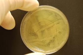 Ozon 1* 24 Sek. (sofort)